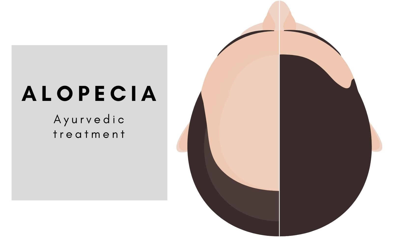Ayurvedic treatment for Alopecia