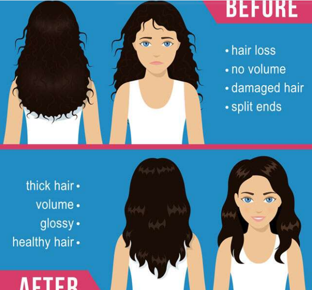 Understand the side effects of hair smoothening, don't regret it later