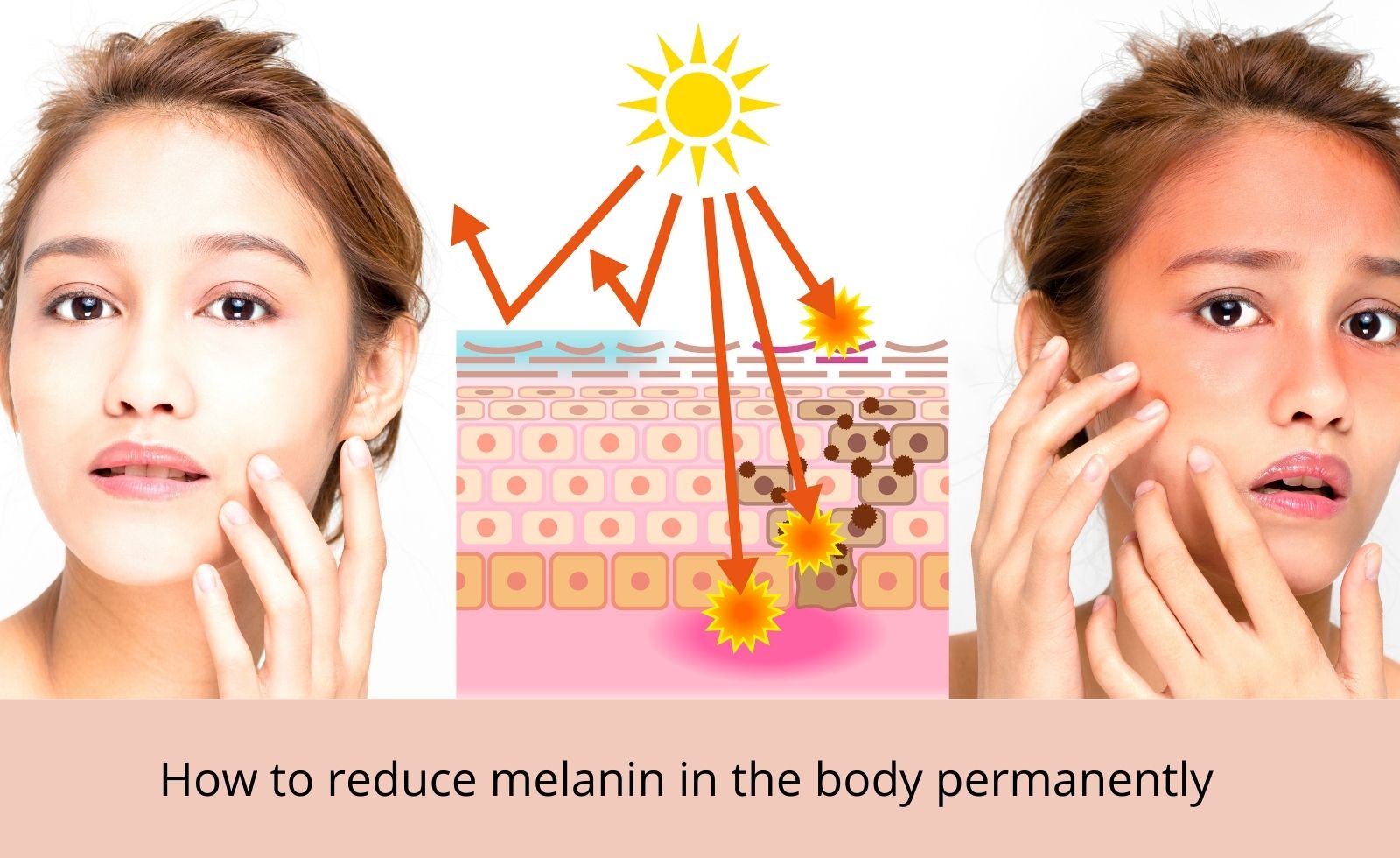 How to reduce melanin in the body permanently