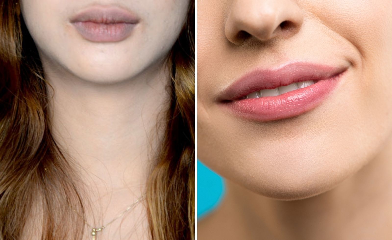 Treatment for dark Lips