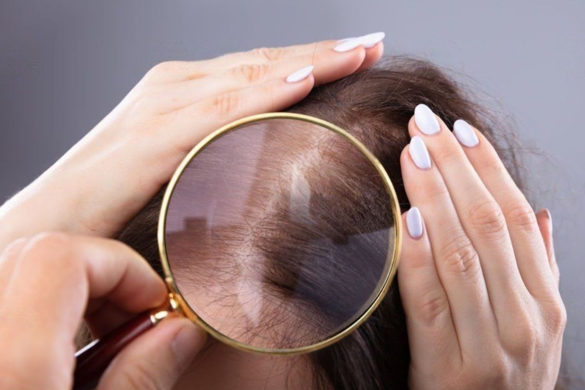 Best hair regrowth oil for baldness in India