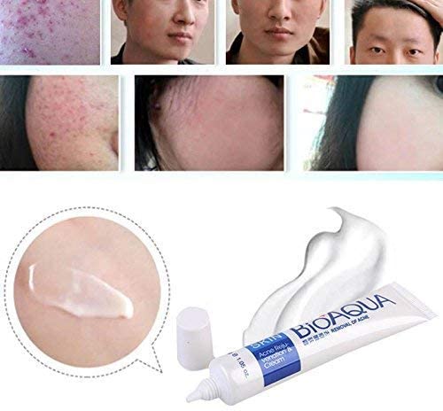 Bioaqua Anti Acne Scar cream