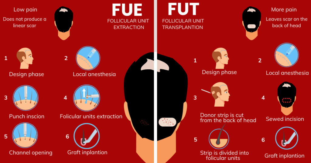 Difference between FUE and FUT hair transplant in kolkata